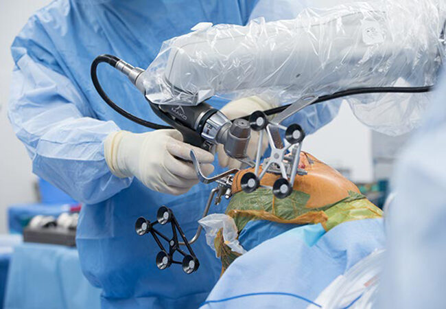 robotic_total_knee_replacement Robotic Total Knee Replacement in India